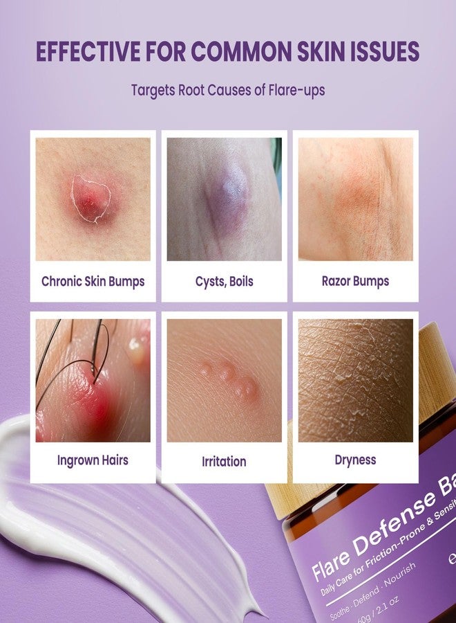 Easment Hidradenitis Suppurativa Flare Defense Balm: 2oz Advanced Science-Backed Salve for HS, Boils, Cysts – Microsilver BG™, Zinc Oxide & Botanical Blend – Cooling Comfort, Non-Greasy, Non-Staining - Image 4